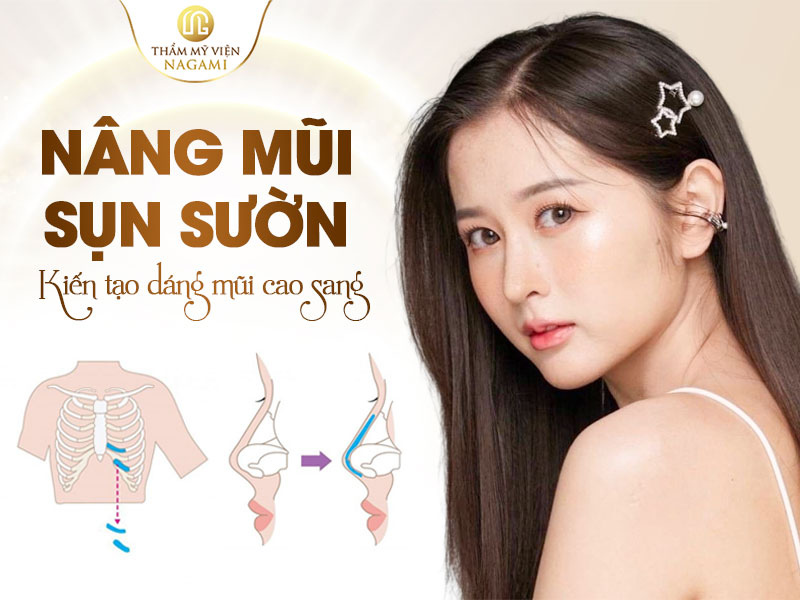 Nâng mũi sụn sườn kiến tạo dáng mũi cao đẹp