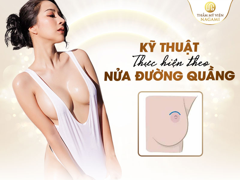 Kỹ thuật thực hiện treo sa trễ 