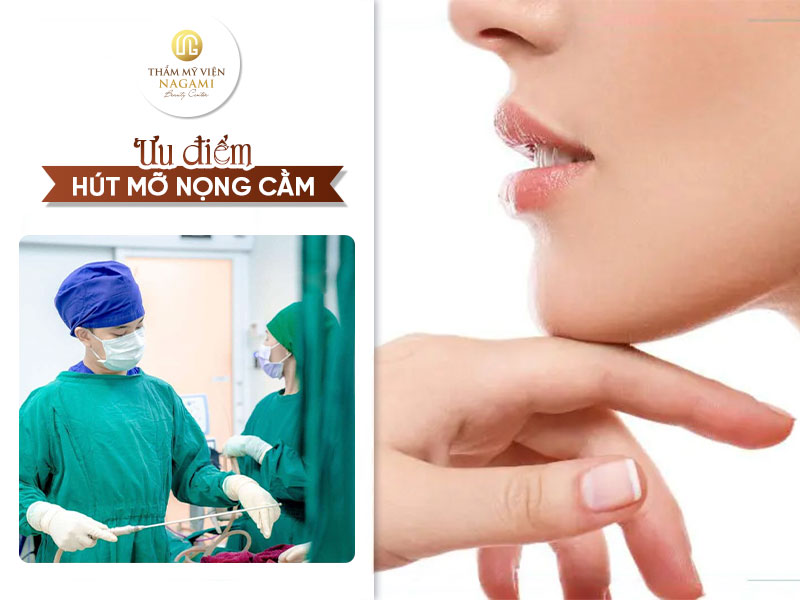 Ưu điểm của hút mỡ nọng cằm