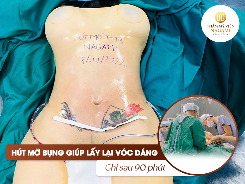 Hút mỡ bụng giúp eo thon chỉ trong 90 phút