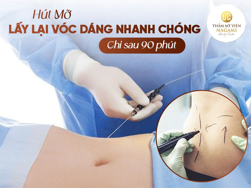 Hút mỡ bụng là cách tốt nhất, để lấy lại vóc dáng cho bạn
