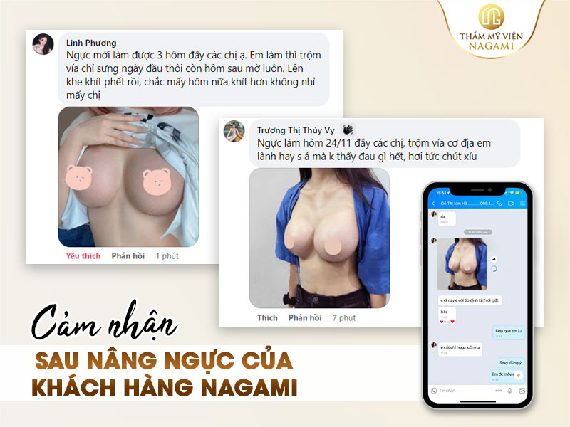 nâng ngực có đau không? cảm nhận của khách hàng