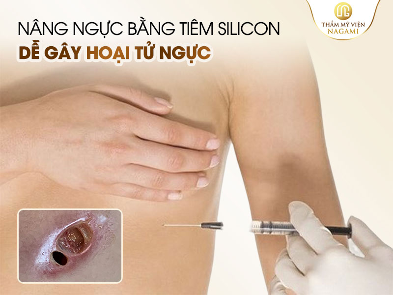 Nâng ngực bằng tiêm silicon dễ gây hoại tử ngực
