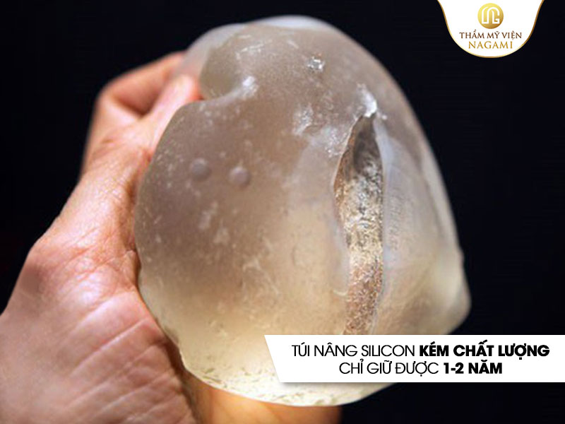 Túi nâng ngực Silicon kém chất lượng, chỉ giữ được 1-2 năm