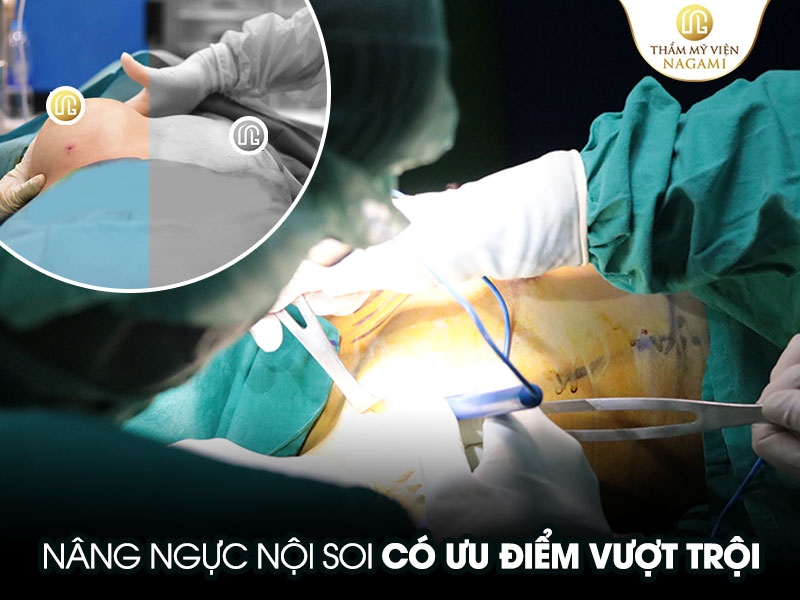 Nâng ngực nội soi có nhiều ưu điểm vượt trội