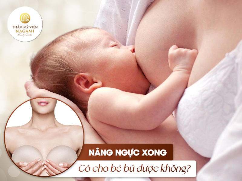 Sau khi thực hiện nâng ngực chị em có thể cho con bú được không