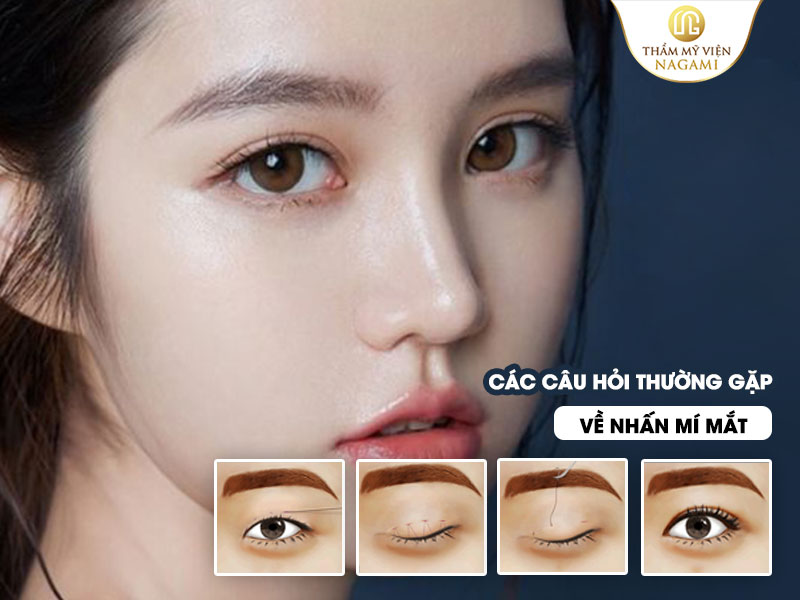 Nhấn Mí Mắt: Giải Pháp Nhanh Chóng Để Có Đôi Mắt Sáng và Rõ Nét!