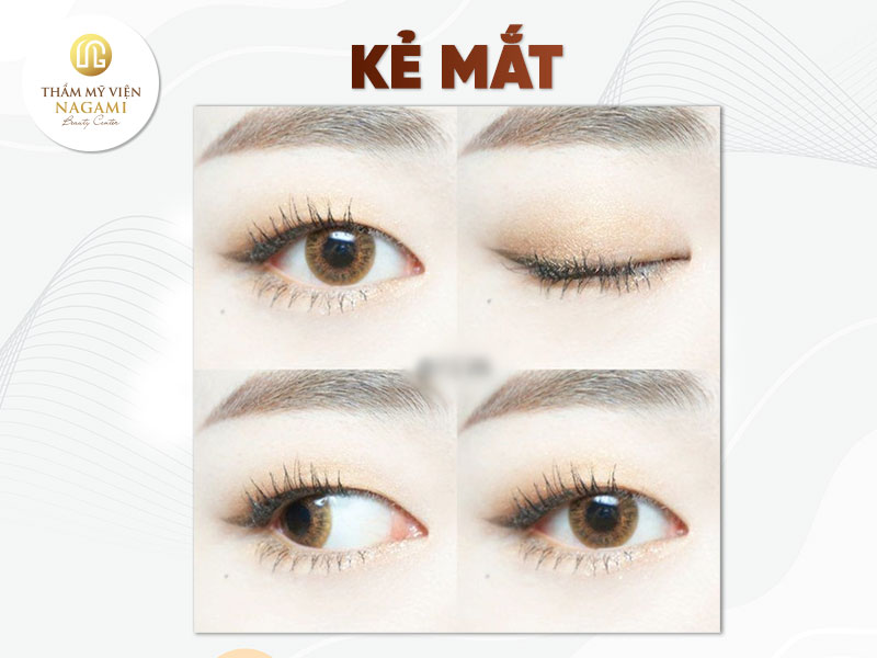 Kẻ mắt