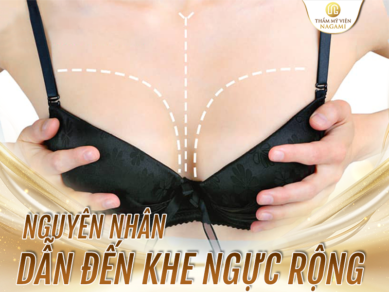 Nguyên nhân dẫn đến khe ngực rộng