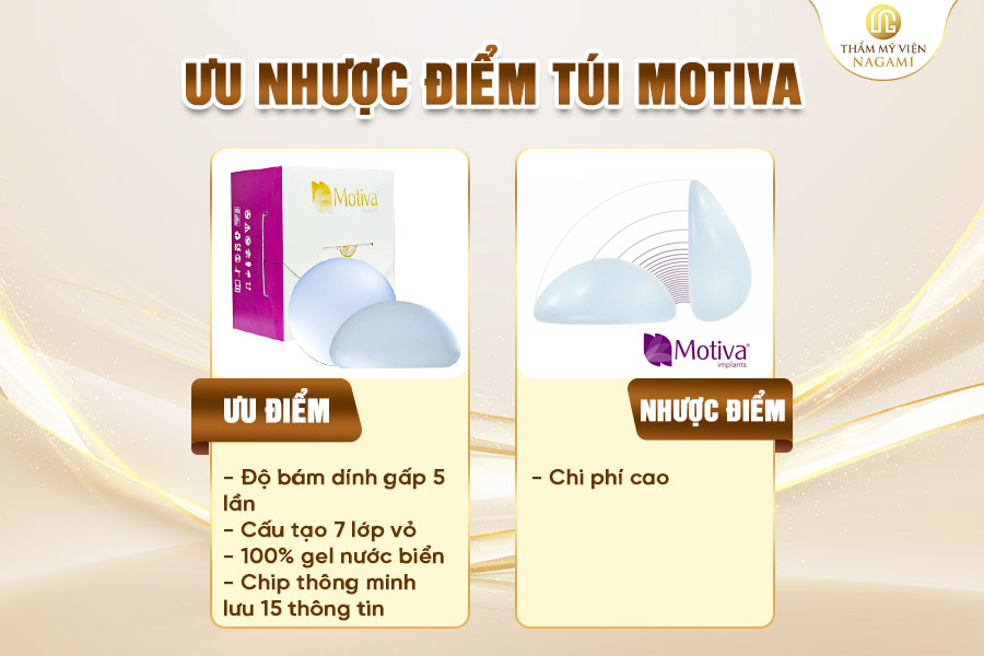 Ưu nhược điểm túi Motiva