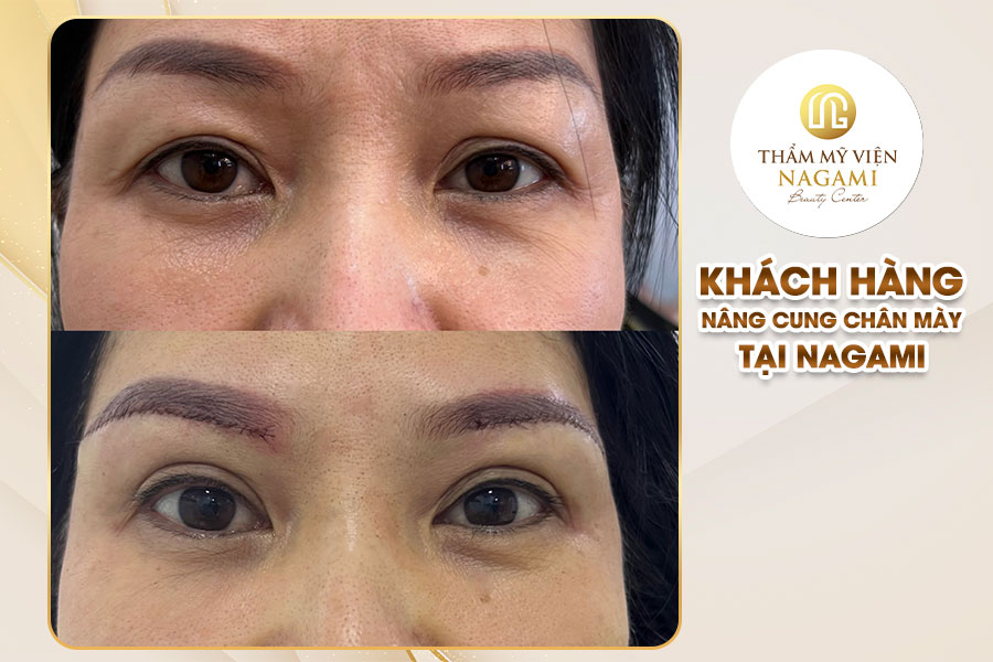 Hình ảnh khách hàng nâng cung chân mày tại Nagami