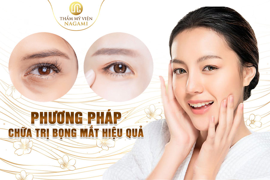 Phương pháp chữa trị bọng mắt hiệu quả