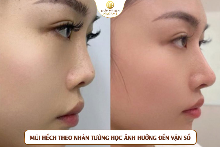 Mũi hếch theo nhân tướng học ảnh hưởng đến vận số