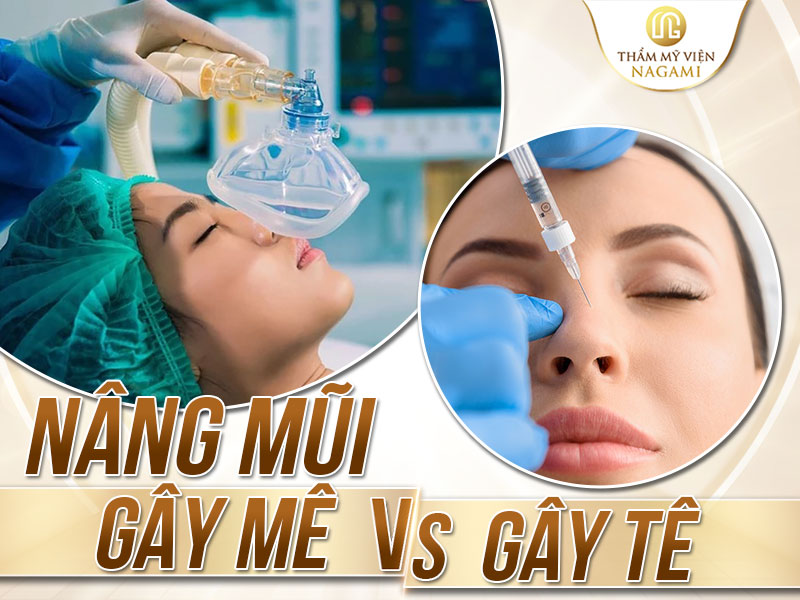 Nâng mũi gây mê hay gây tê