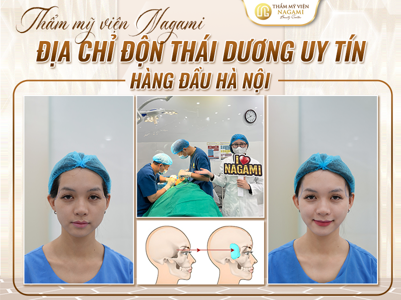 Thẩm mỹ viện Nagami - Địa chỉ độn thái dương uy tín hàng đầu Hà Nội
