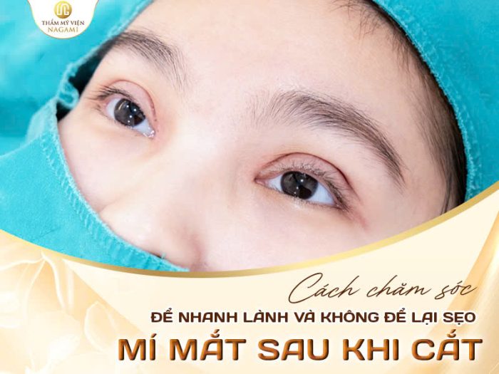 Cách chăm sóc sau cắt mí
