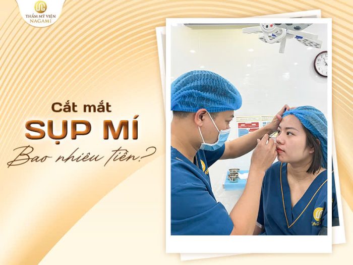 Cắt mắt sụp mí bao nhiêu tiền