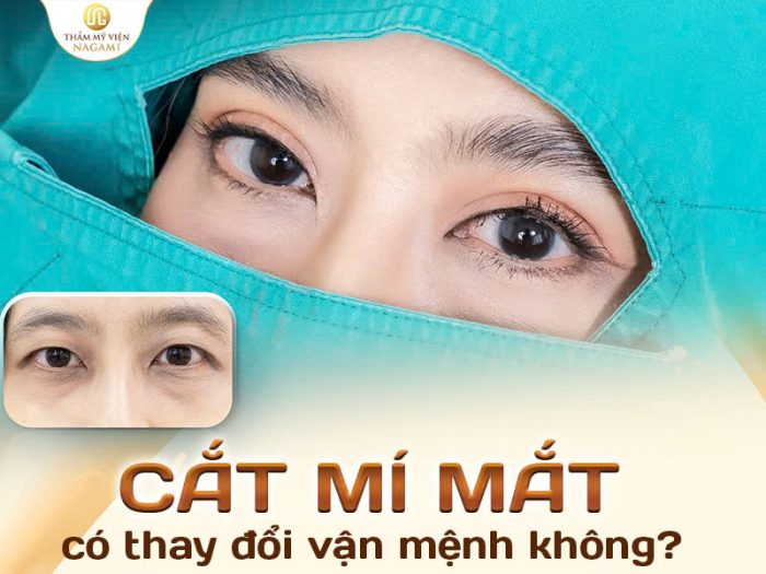 Cắt mí có thay đổi vận mệnh không?