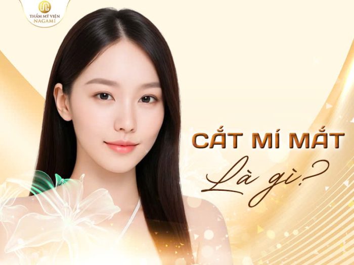 Cắt mí mắt là gì?