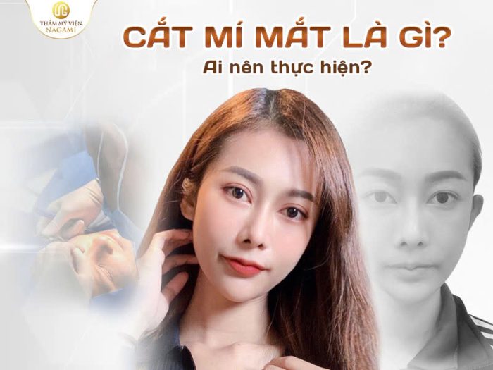 Cắt mí mắt là gì