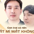 Con trai có nên cắt mí không?