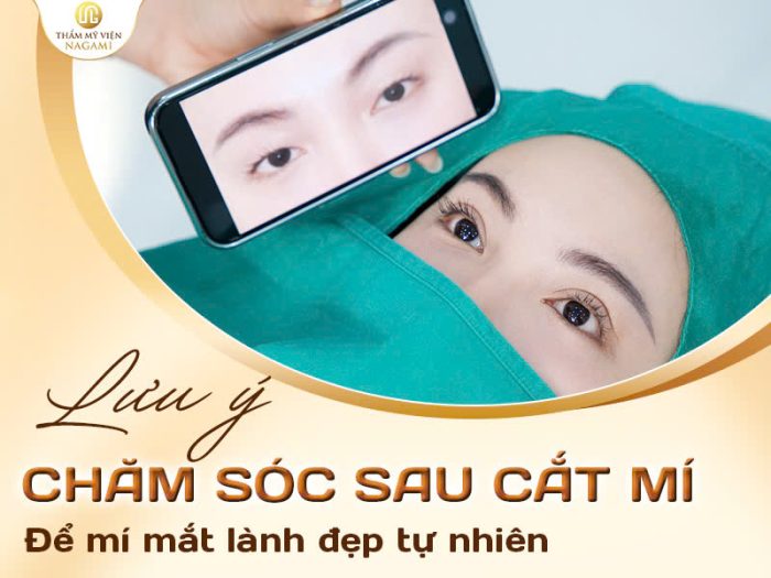Lưu ý chăm sóc sau cắt mí