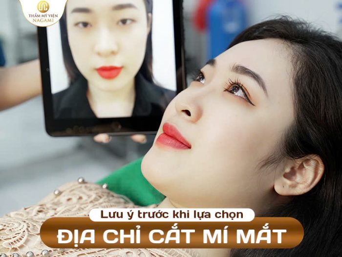 Lưu ý khi lựa chọn địa chỉ cắt mí