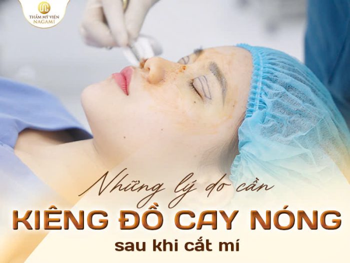 Lý do cần kiêng đồ ăn cay nóng sau cắt mí