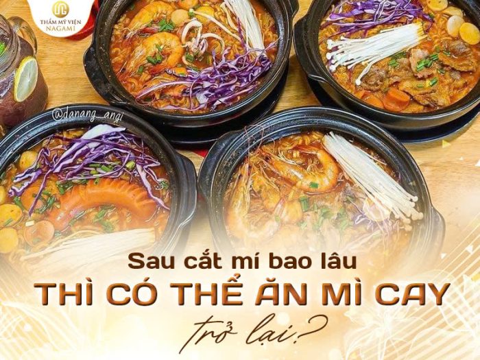 Sau cắt mí bao lâu có thể ăn mì cay