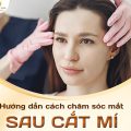 Hướng dẫn cách chăm sóc sau cắt mí