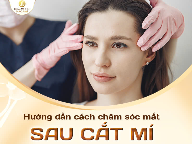 Hướng dẫn cách chăm sóc sau cắt mí