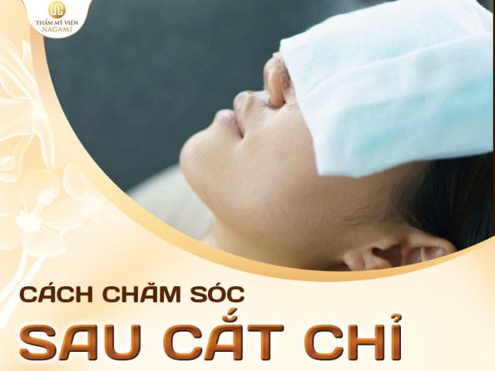 Cách chăm sóc mí mắt sau cắt chỉ