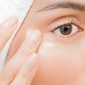Cắt mí có cần bôi thuốc chống sẹo không?