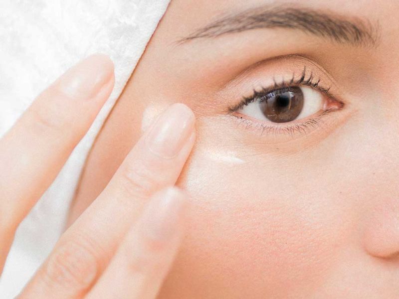 Cắt mí có cần bôi thuốc chống sẹo không?