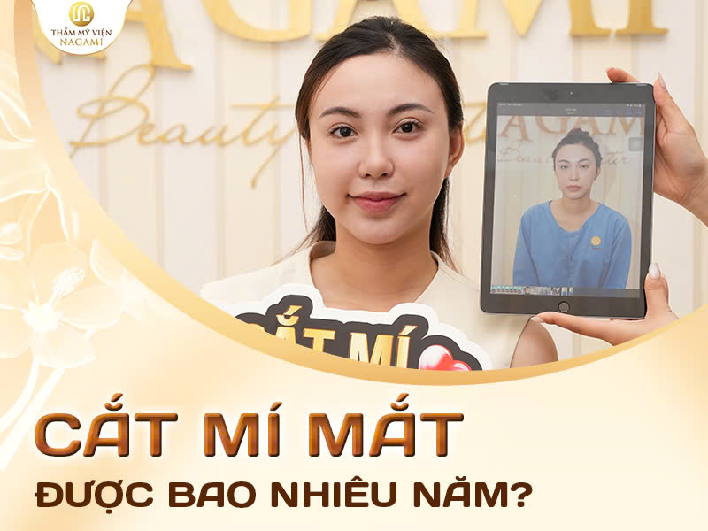 Cắt mí mắt được bao nhiêu năm