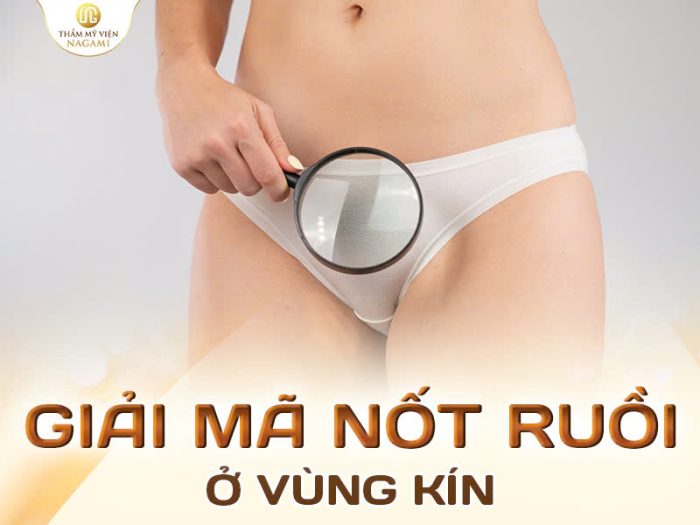 Giải mã nốt ruồi ở vùng kín