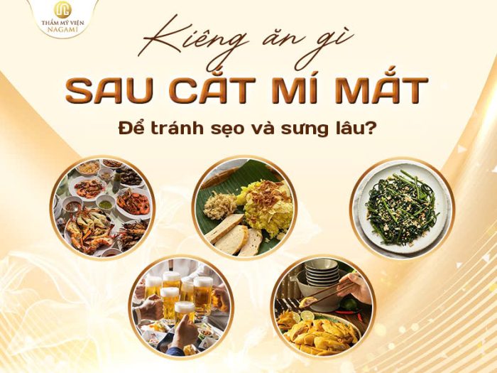 Kiêng ăn gì sau cắt mí
