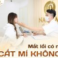 Mắt lồi có nên cắt mí