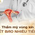 Thẩm mỹ vùng kín hết bao nhiêu tiền